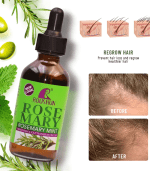 Roushun Rosemary Mint Oil